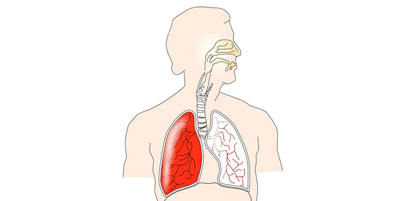 Pulmonary Quizzes, Pulmonary Trivia, Pulmonary Questions